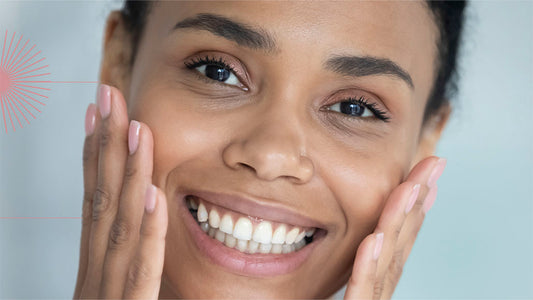 mulher sorrindo com as mãos nas bochechas mostrando as linhas de expressão em seu rosto